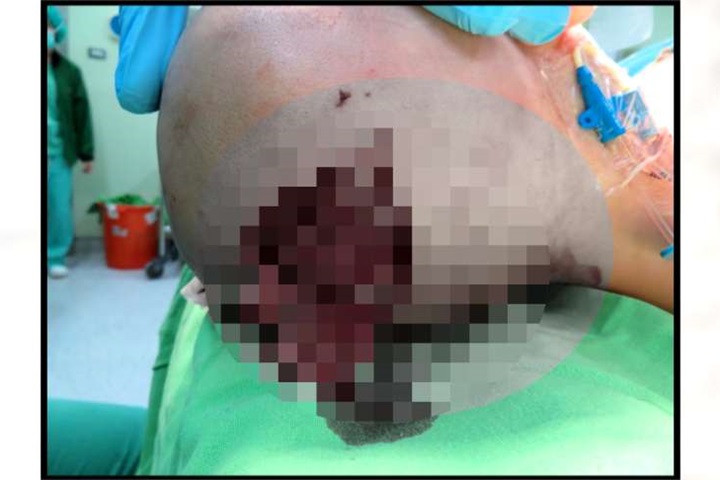 Life生活網 1歲男童遭比特犬攻擊頭蓋骨粉碎險喪命