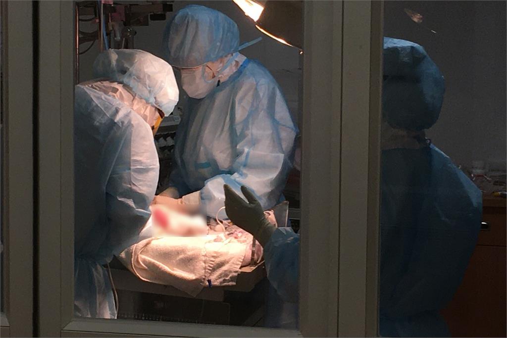 武肺確診孕婦「難呼吸」插管剖腹生產　台北慈濟醫院平安保住母女2命