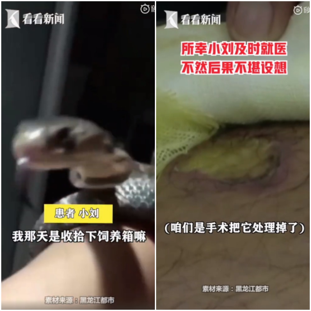 中國男網購「無毒」寵物蛇　同床1週後卻被咬險死？店家改稱：發錯貨