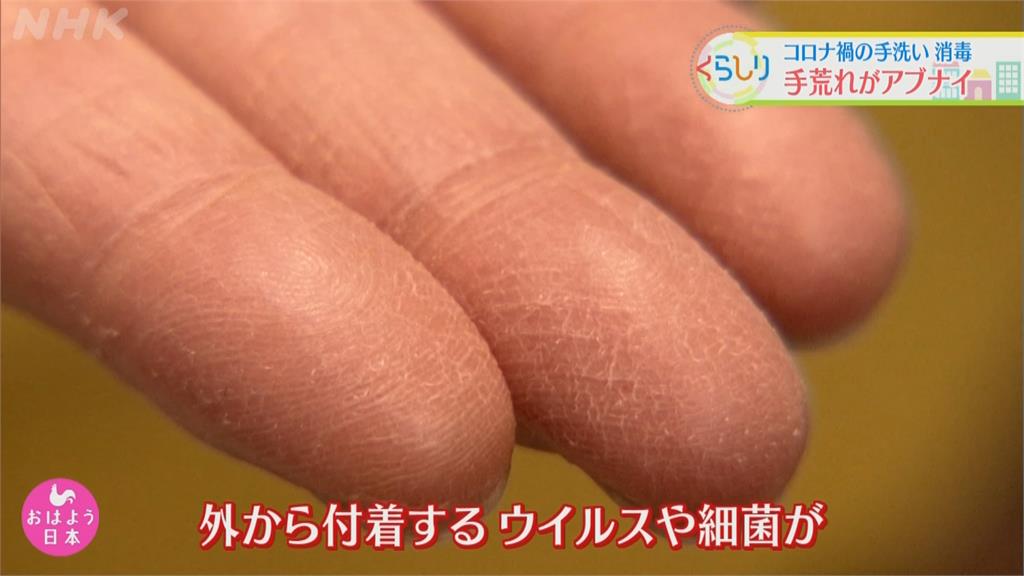 用力防疫狂洗手  破皮乾裂易積菌！保養雙手  日本專家有撇步